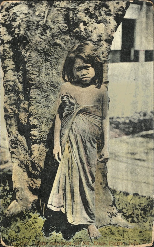 No. 100. Sole survivor of Mt. Dajo fight, Jolo, P. I.