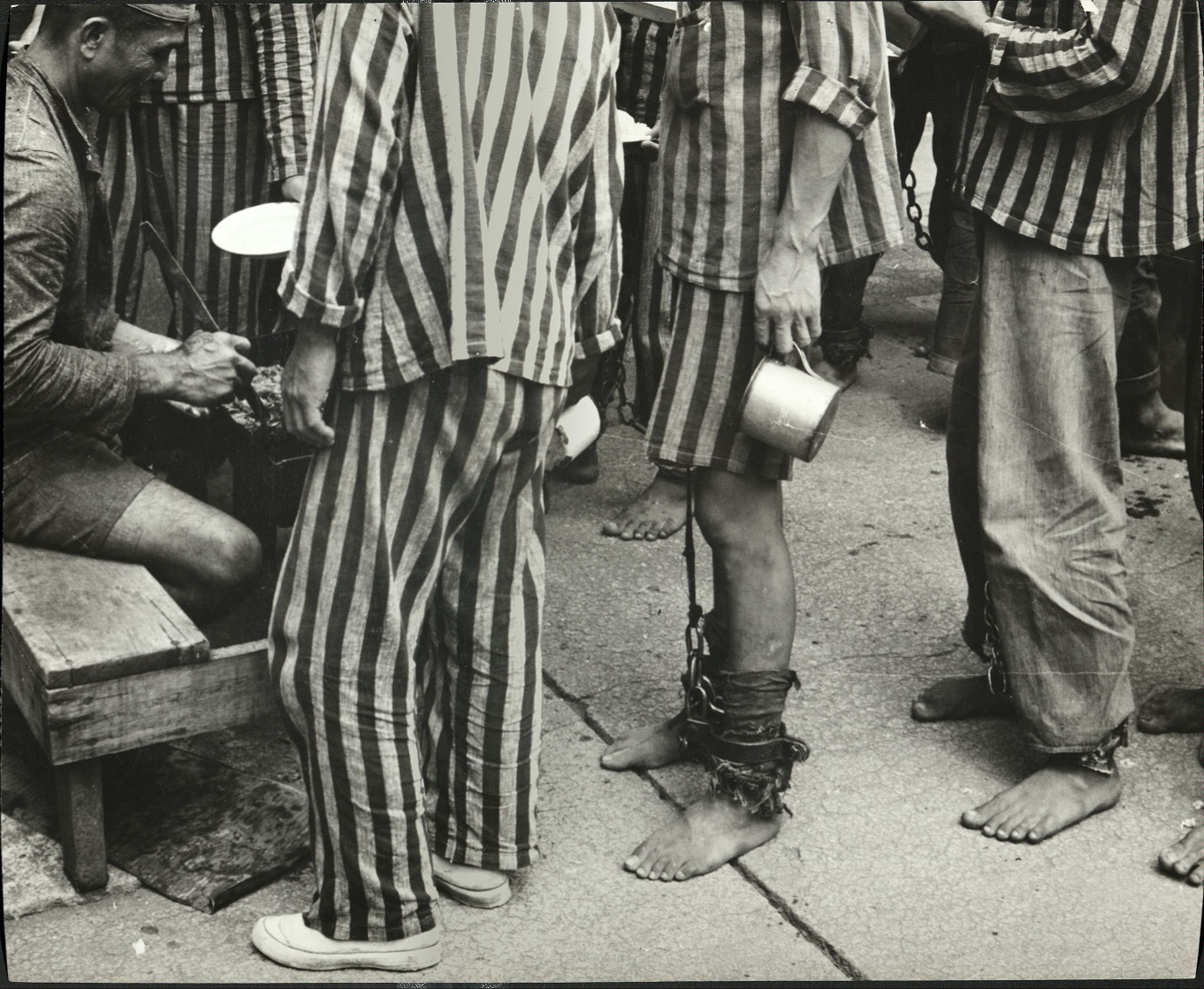 3. The legs of prisoners at the San Ramon Penal Colony at Zamboanga, Philippines.