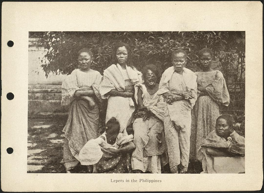 Lepers in the Philippines
