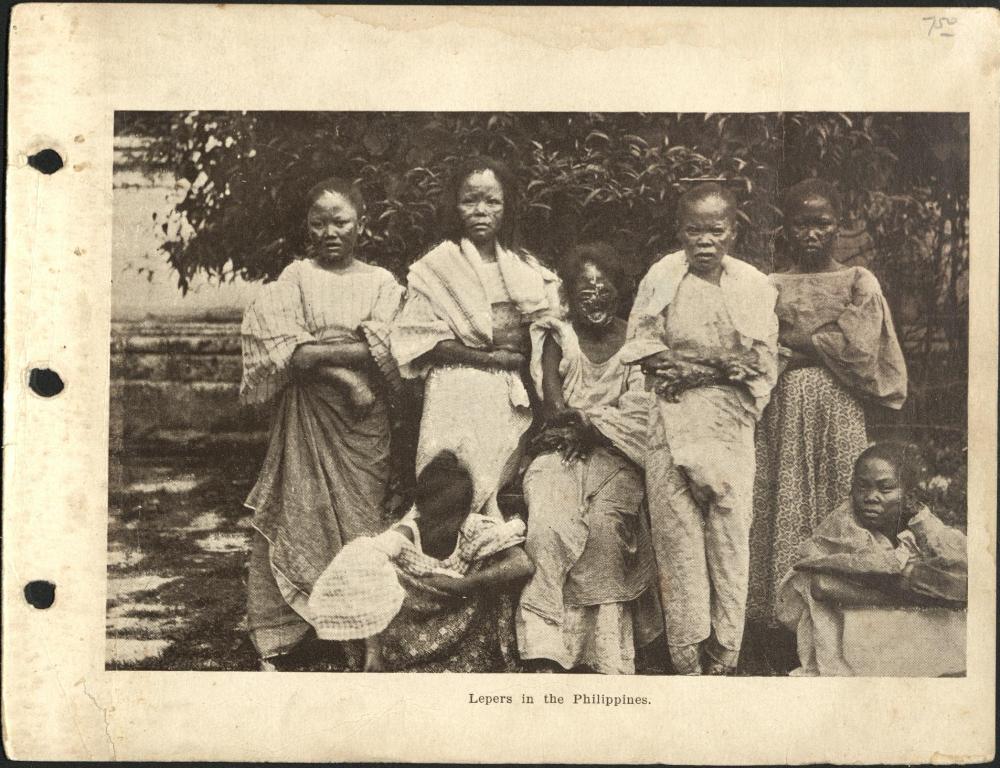 Lepers in the Philippines.