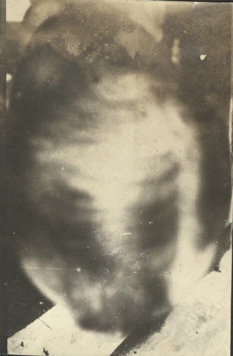 November [1919]. Those grand hikes. “Before.”