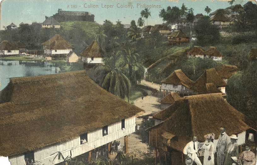 A 183 ï¿½ Culion Leper Colony, Philippines.